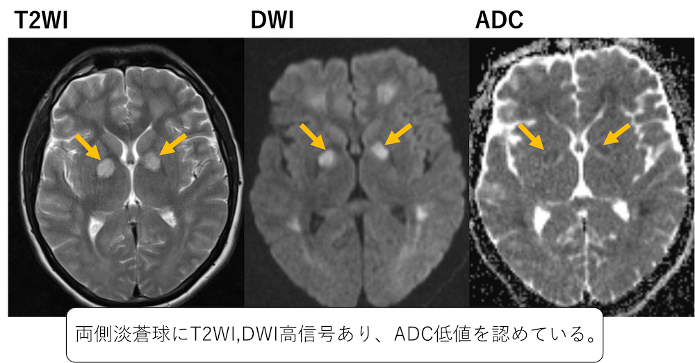 MRI検査 ｜ ページ 3